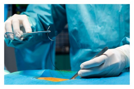 Laparoscopic surgery