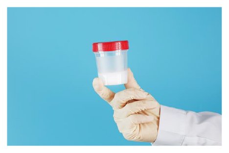 Semen Freezing