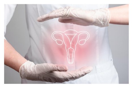 Fertility Preservation
