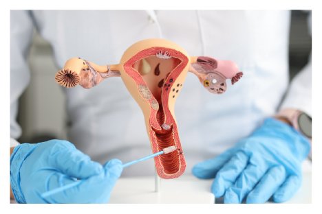 Endometrial Receptivity Test